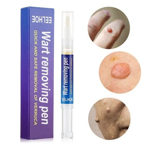 Warts Remover Original Cream Wart Removal Ointment Wart Treatment Skin Tag Mole Remover Antibacterial Foot Wart